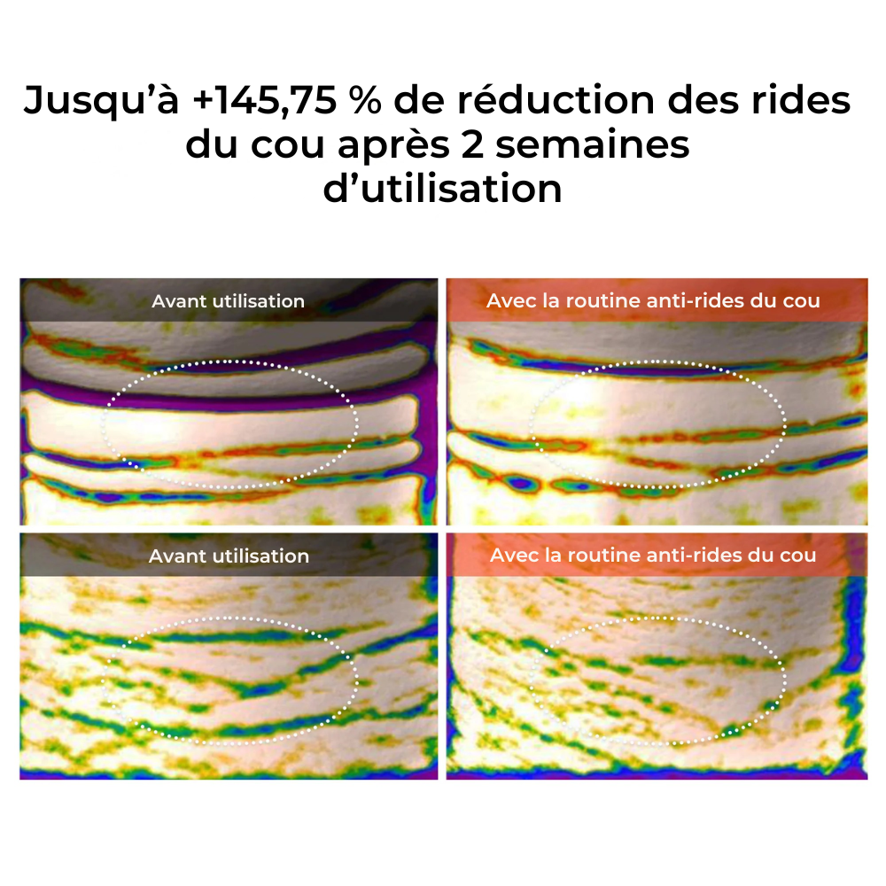 Trio Anti-Rides du Cou — Kit 3 Soins Dr.Melaxin