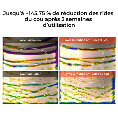 Trio Anti-Rides du Cou — Kit 3 Soins Dr.Melaxin